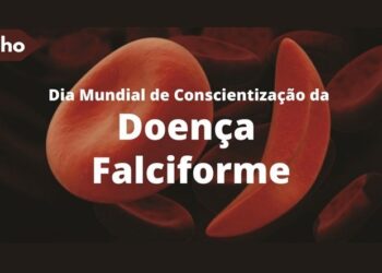 Hemoes realiza ação direcionada a pacientes com Doença Falciforme